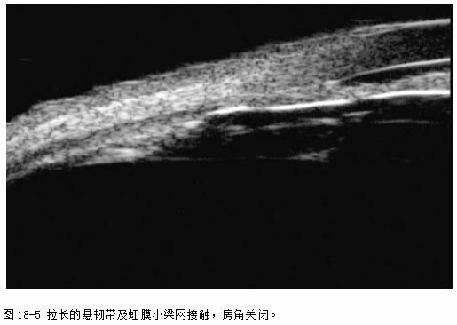 ZY016_91_2.gif